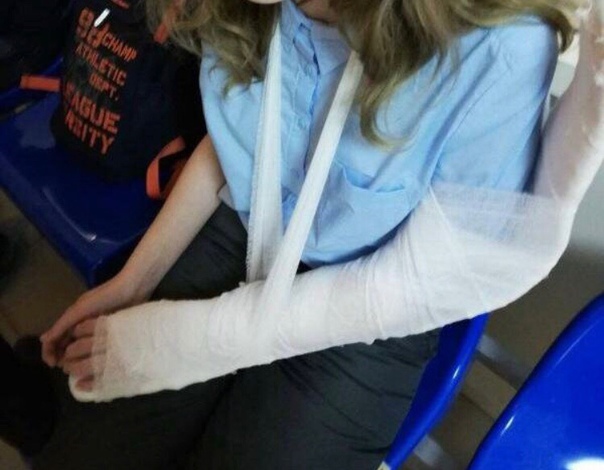 В Казани пенсионерка выходила из автобуса и толкнула школьницу, девочка упала и сломала руку 13-летняя